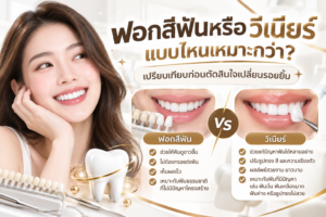 ฟอกสีฟันหรือทำวีเนียร์